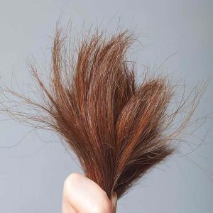 درمان موخوره